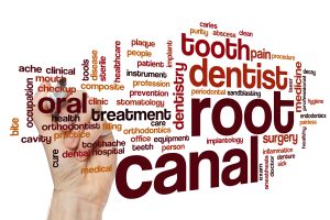 root canal procedure