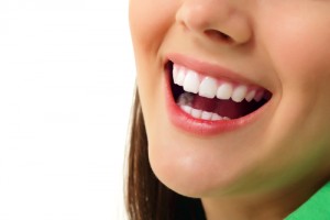 veneers