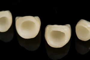 dental crowns 1